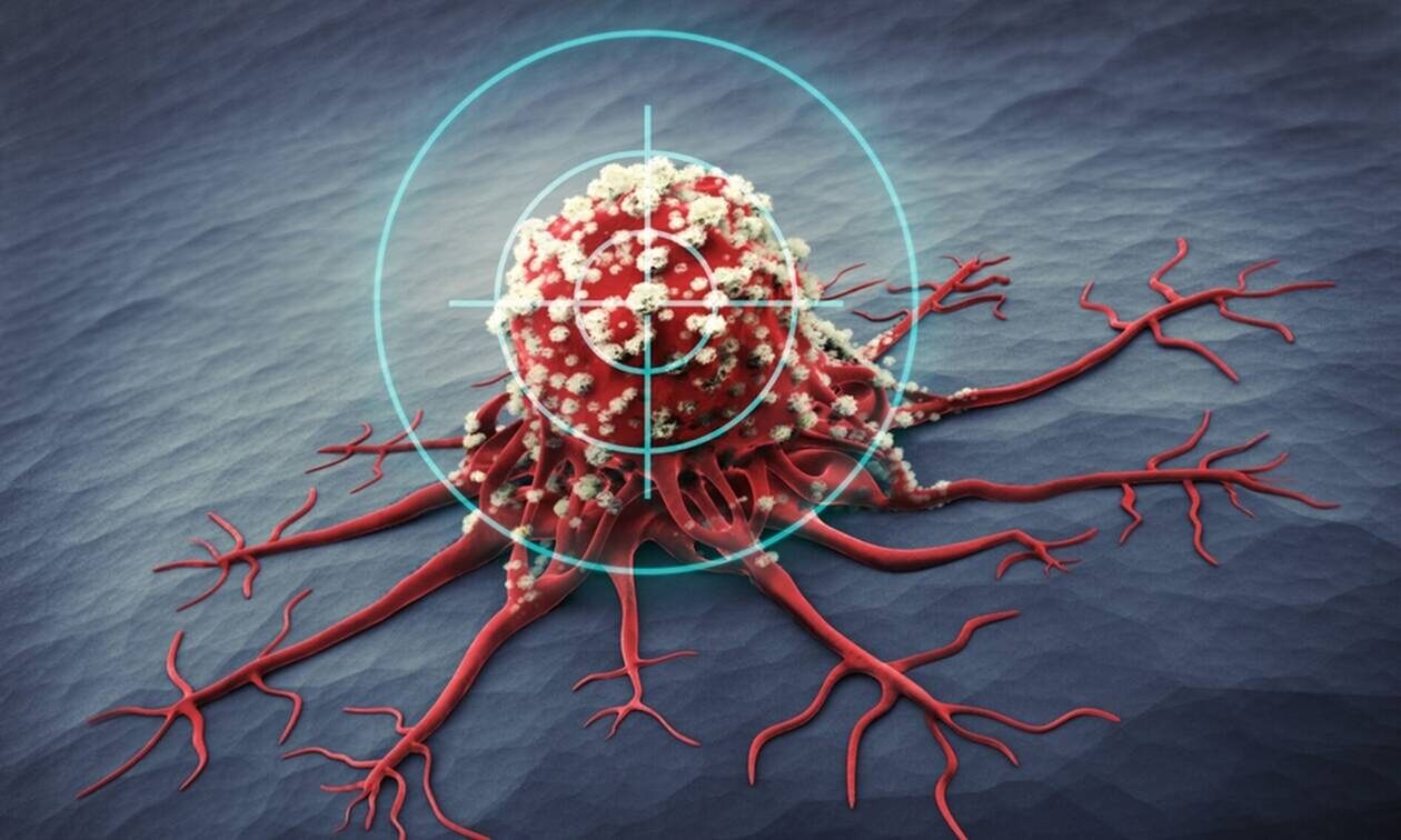 Πρωτοποριακή έρευνα Ελλήνων επιστημόνων ανοίγει τον δρόμο για εξατομικευμένη θεραπεία του καρκίνου