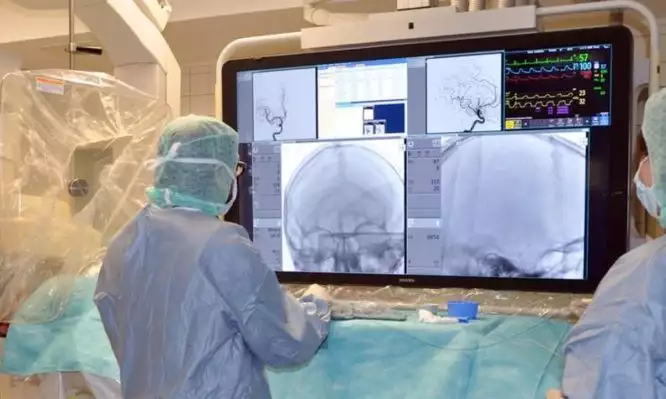 Πώς θα στελεχωθούν οι Μονάδες Εγκεφαλικών σε όλη τη χώρα