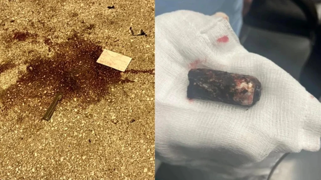 Μάχη για τη ζωή του δίνει ο 31χρονος αστυνομικός – Στην Αθήνα οι συγγενείς του