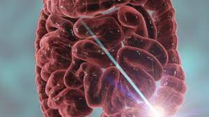 Οι παρεμβάσεις στη διάθεση μπορούν να μειώσουν τη φλεγμονή στη νόσο του Crohn και την ελκώδη κολίτιδα