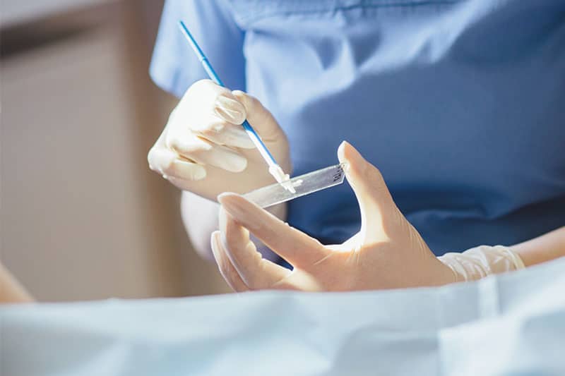 Δωρεάν τεστ Παπανικολάου από την Αντιδημαρχία Κοινωνικής Μέριμνας