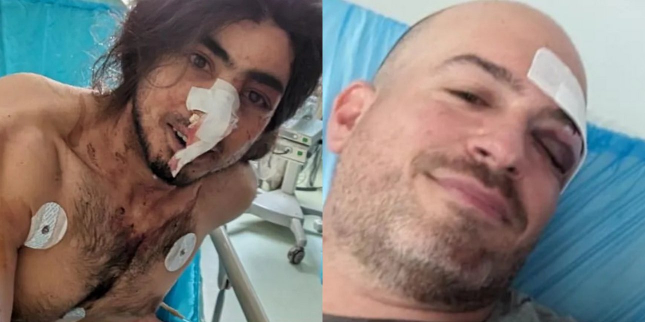 Εξιχνίασε την υπόθεση με τον ξυλοδαρμό στην Πάρνηθα η ΕΛ.ΑΣ