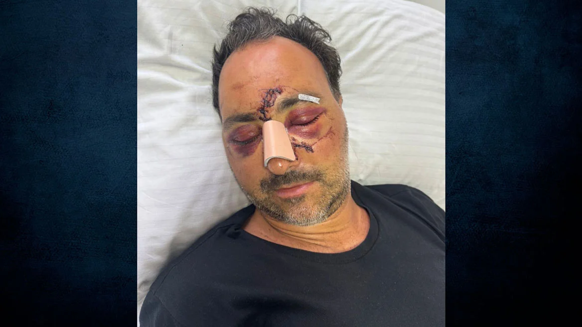 Δεν αποδέχονται την απόπειρα ανθρωποκτονίας για τον ξυλοδαρμό του Ελληνοκαναδού